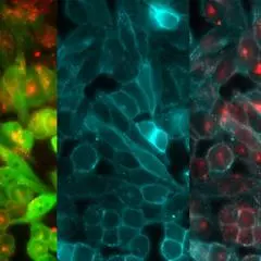 Association of Nuclear Medicine and Molecular Imaging (ANMMI)